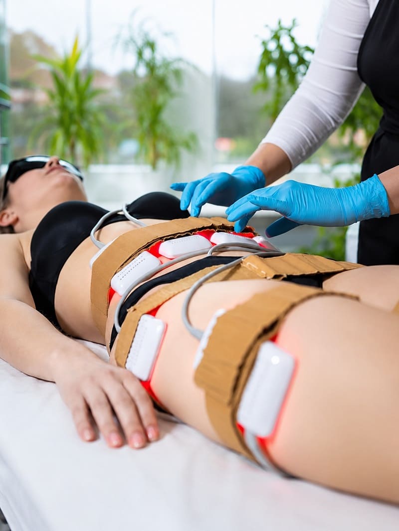 Aplicação de lipo laser não invasivo na região abdominal